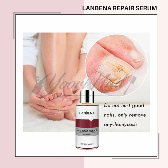 Lanbena nail repair serum kuku berjamur vitamin kuku rusak
