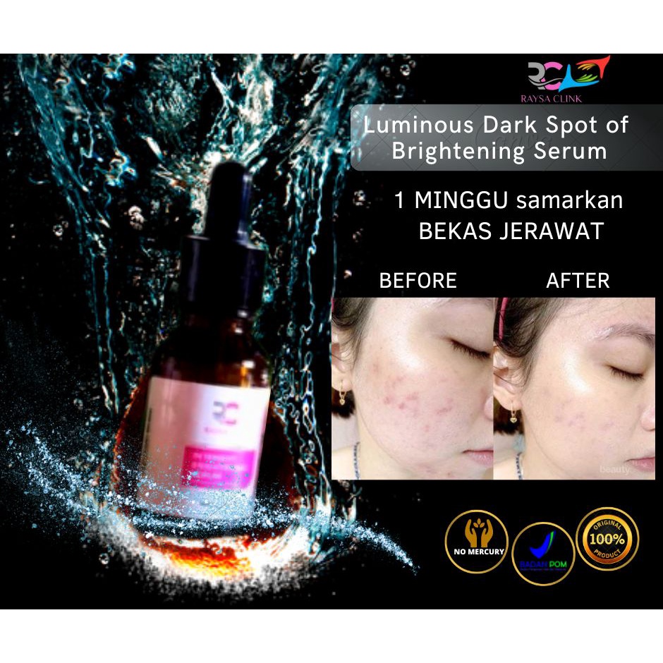 Raysa Clink Dark Spot Brightening Serum (10% Niacinamide + 6X Ceramide - Skincare Pencerah Muka dan 