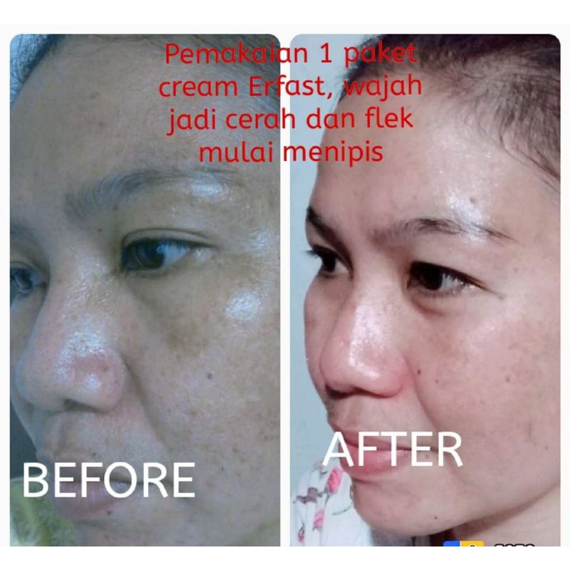 Erfast skincare
