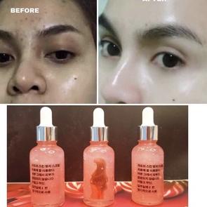Terlaris hari ini SERUM WAJAH MULGWA GLOWING KOREA MENJADIKAN WAJAH PUTIH CERAH GLOW MULUS PEMUTIH P