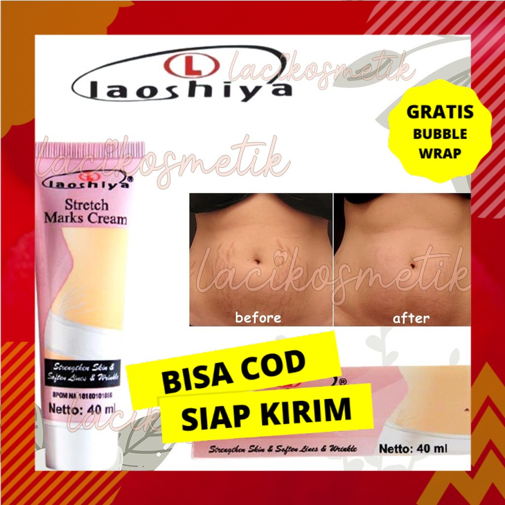 Penghilang Stretchmark Ampuh Ibu Hamil Permanen Pantat Pria Wanita Bokong BPOM Permanen