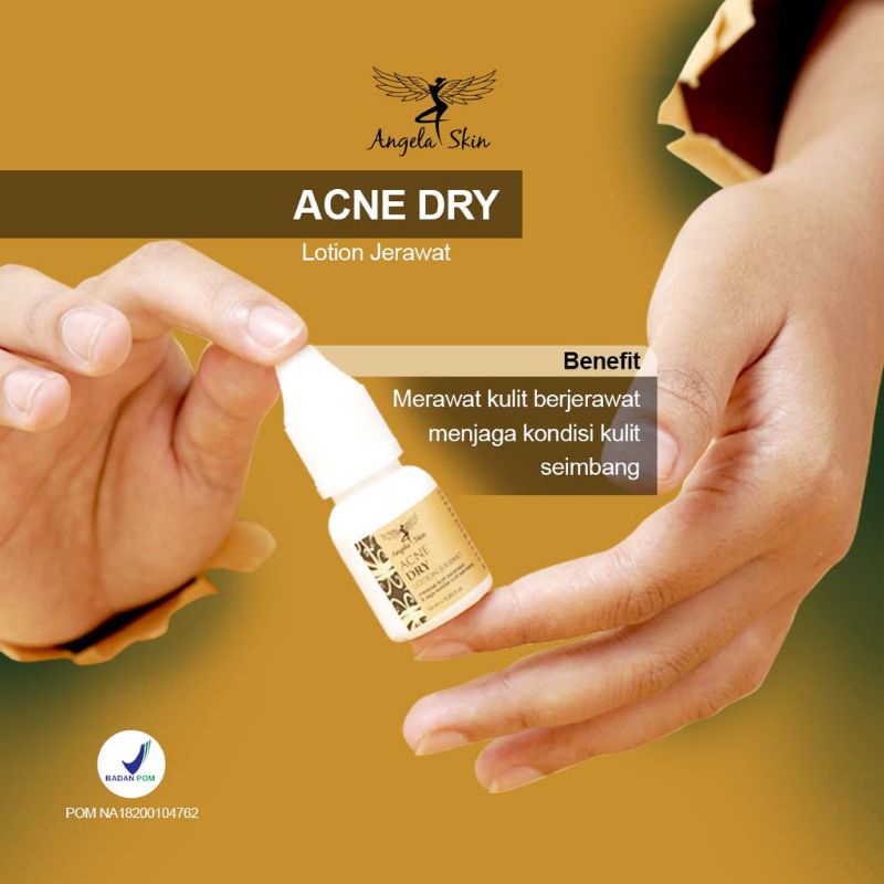 Acne Dry Angela Skin