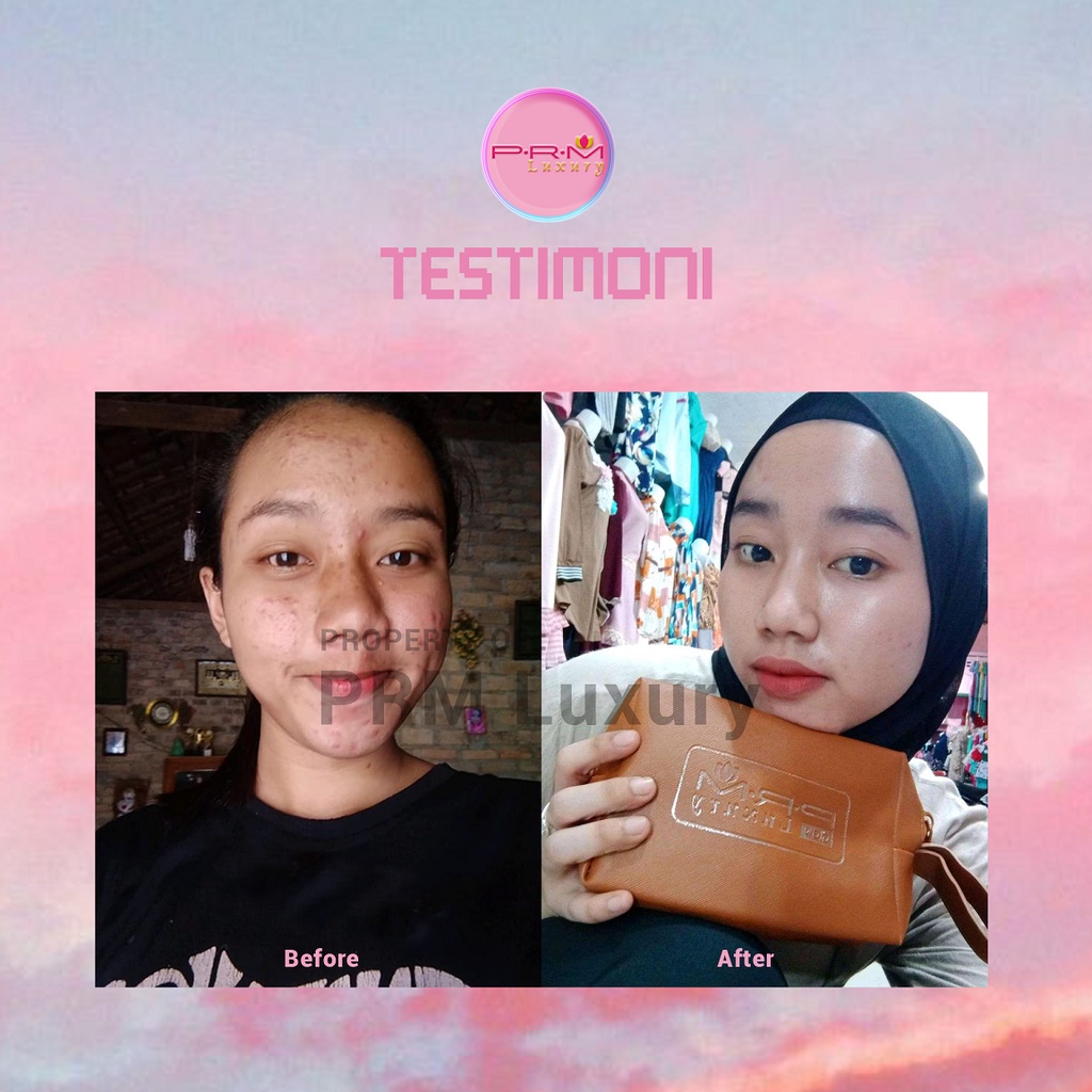 TONER SERIES ACNE PRM LUXURY &amp; GLOW LUXURY SKINCARE BPOM
