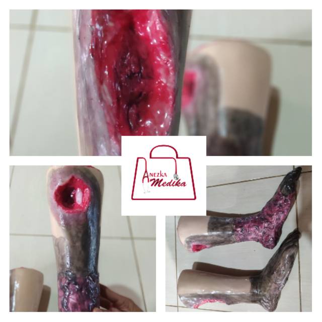 PHANTOM / MANEKIN / MANIKIN KAKI LUKA DECUBITUS