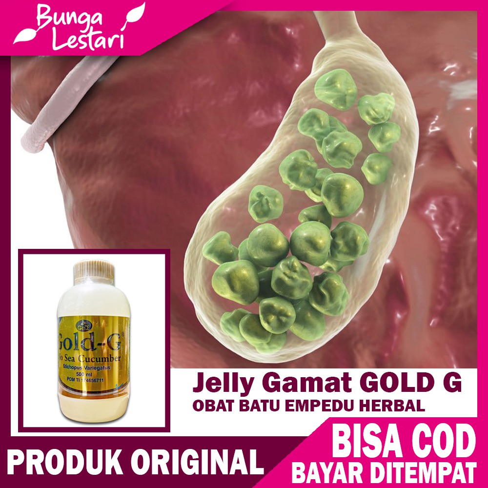 Obat Penghancur Batu Empedu Tanpa Operasi