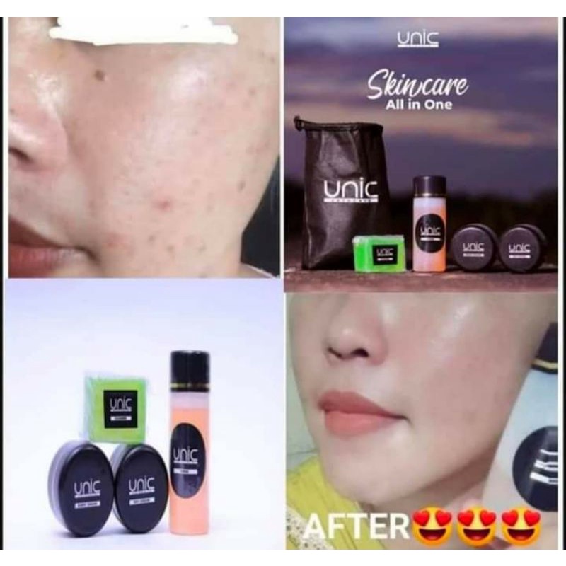 UNIC Skincare Harga Ecer