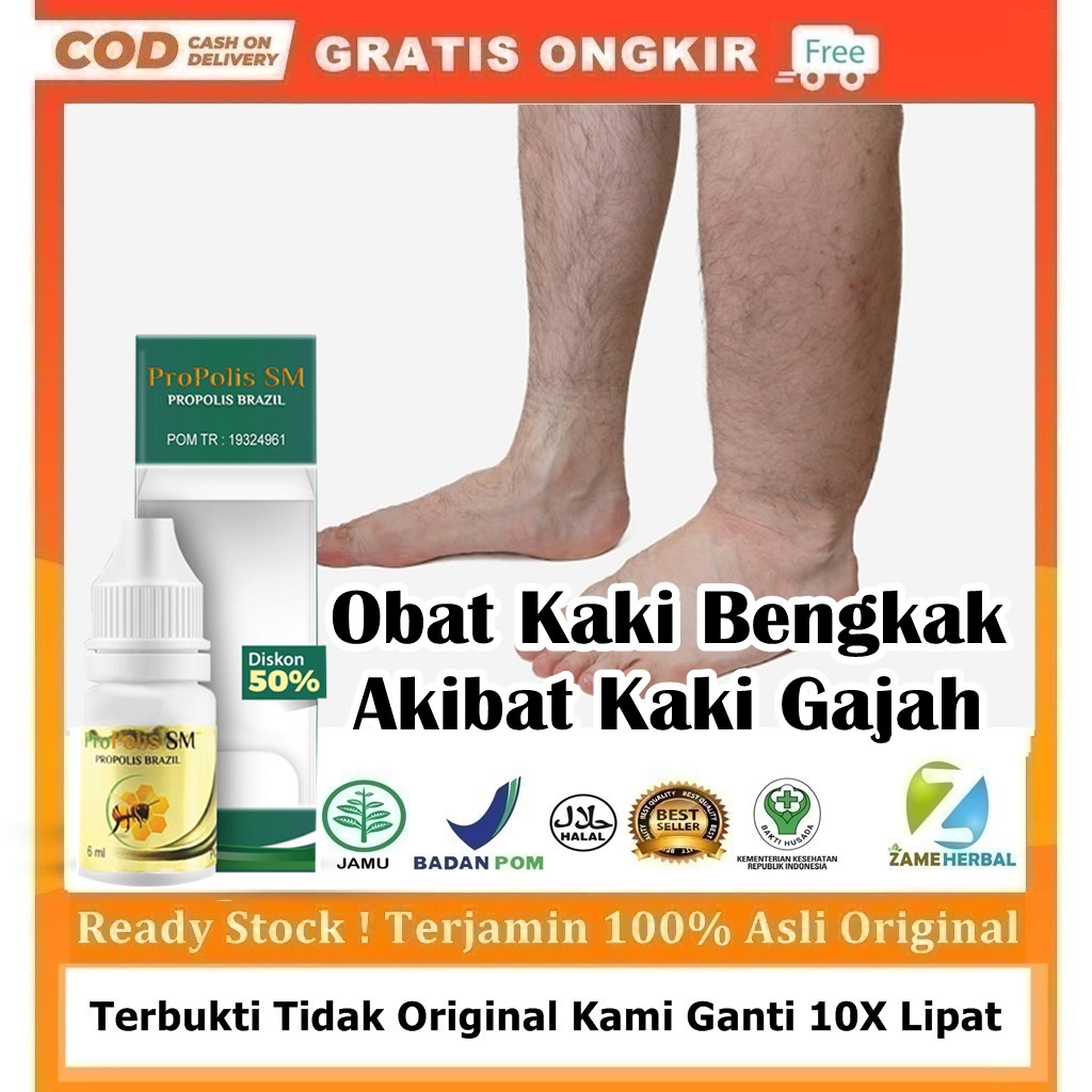 Jual Obat Kaki Bengkak Akibat Kaki Gajah Obat Filariasis Akut Obat Filariasis Kronis Obat