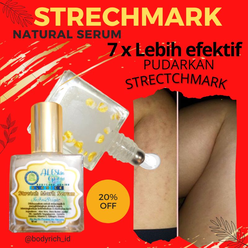 SALE PROMO !! ALARICE STRECHMARK CREAM PENGHILANG STRETCH MARK PALING AMPUH PERMANEN UNTUK IBU HAMIL