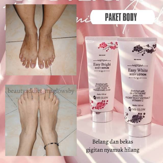 Paket Body Whitening / MS Glow Whitening pigmented body series / MS Glow Easy White Body Series