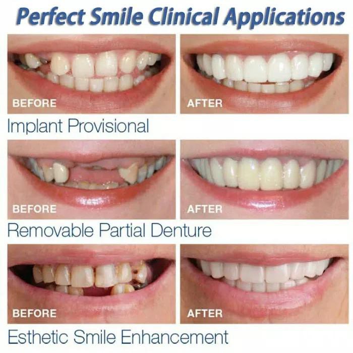 Promo Harga Murah Snap On Smile Gigi Palsu Snap Instan Perfect Smile Shopee Indonesia