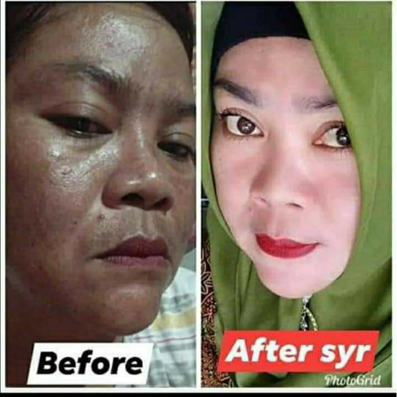 (COD) BPOM Paket Lengkap Skincare Syahreni Glowing Super Lengkap Komplit SYR original 100% Asli Ori Serum Gold Terbaru 2021 Versi Syahraeni Grosir Wajah Face mengatasi Jerawat Beruntusan Flek Hitam membandal perawatan terbaik Aman Skin Care Medan Resmi-5