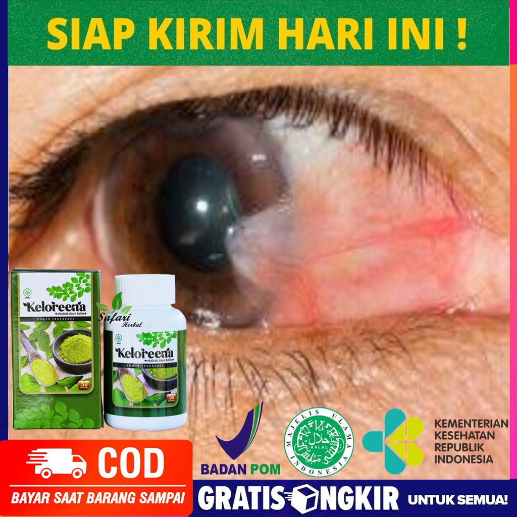 Obat Mata Berlemak - Spesialis Penghilang lemak di mata, Pembersih Pterigium, Pembersih Lamad mata