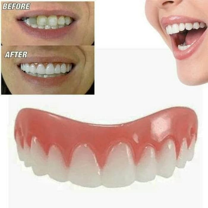 Super Murah Gigi Palsu Instan Perfect Smile Veneer Gigi Tiruan Bagian Atas Shopee Indonesia