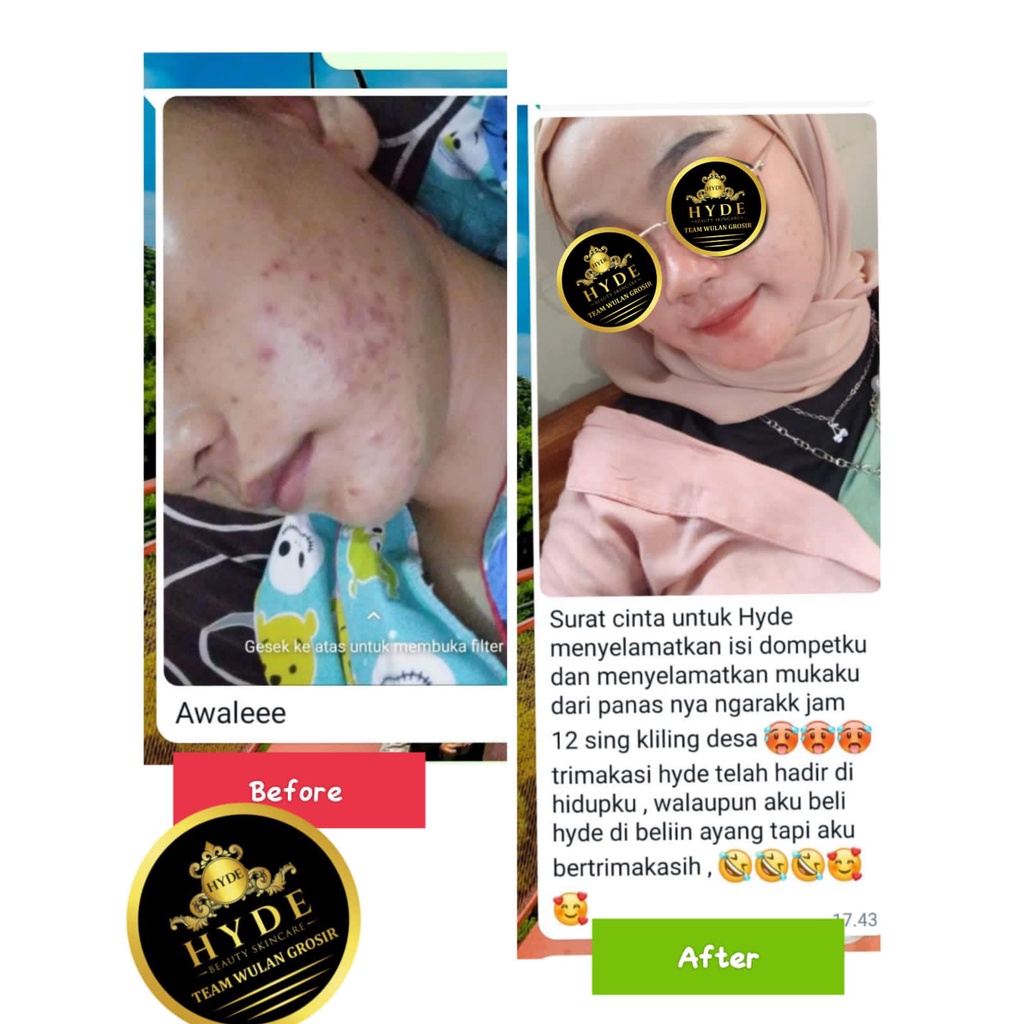 Hyde Beauty Skincare Paket Glowing isi 4 Toner