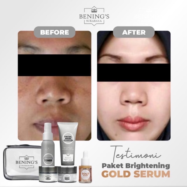 BENING'S PAKET BRIGHTENING | MENCERAHKAN &amp; MENGATASI KULIT KUSAM