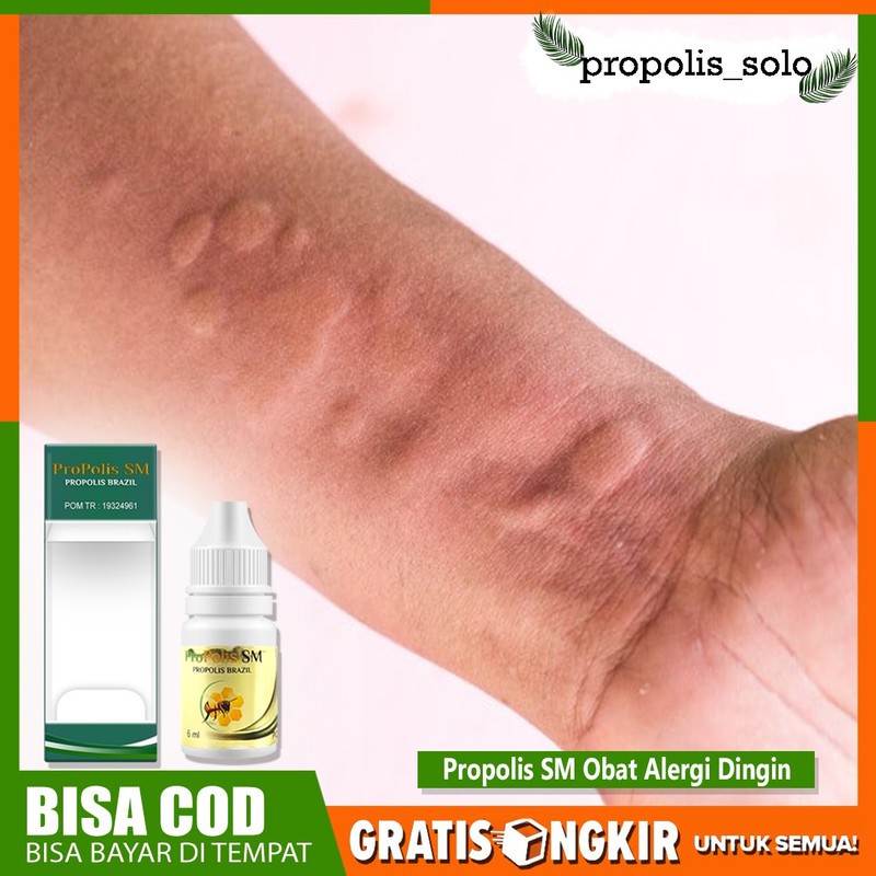 Obat Alergi Panas - Alergi - Obat Alergi Anak - Obat Alergi Sinusitis - Propolis Sm Brazilian