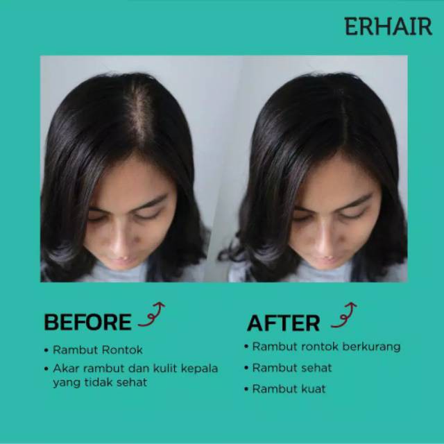 Erha Erhair Hair Grow Serum 7 Days 7x8ml Perawatan Rambut Rontok Shopee Indonesia