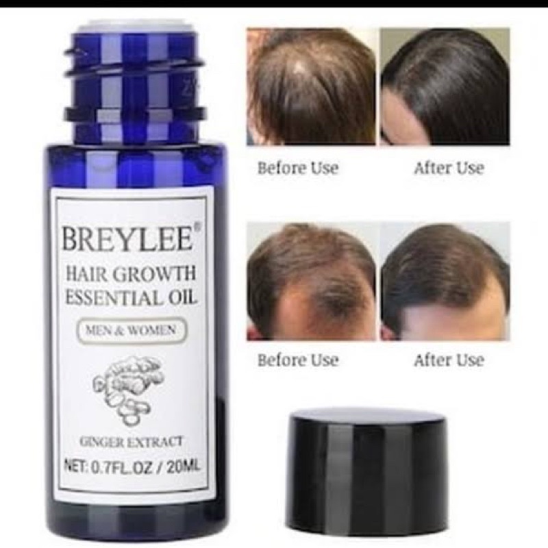 &lt;ck&gt; breylee hair growth essential oil -- minyak penumbuh rambut breylee