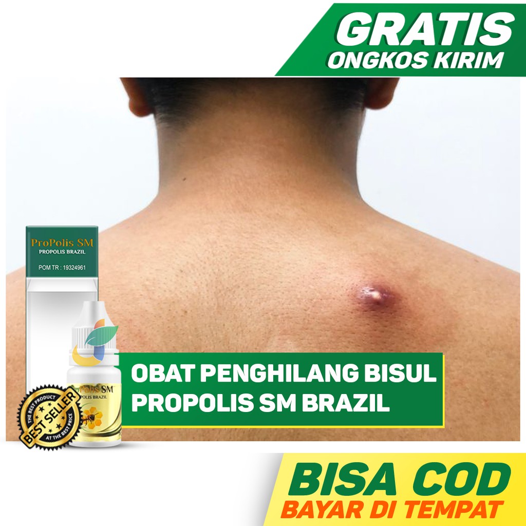 Obat Penghilang Bisul - Cenang - Bisul Menahun Di Ketiak - Kepala Paling Terbaik Original BPOM
