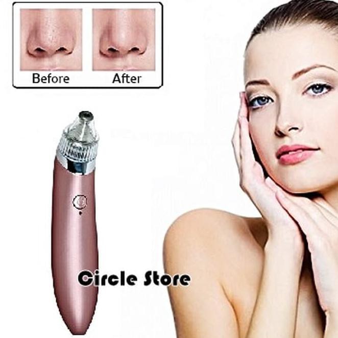 Sale Vacuum Komedo / Electric Blackhead Acne Facial Vacuum Pore Cleaner