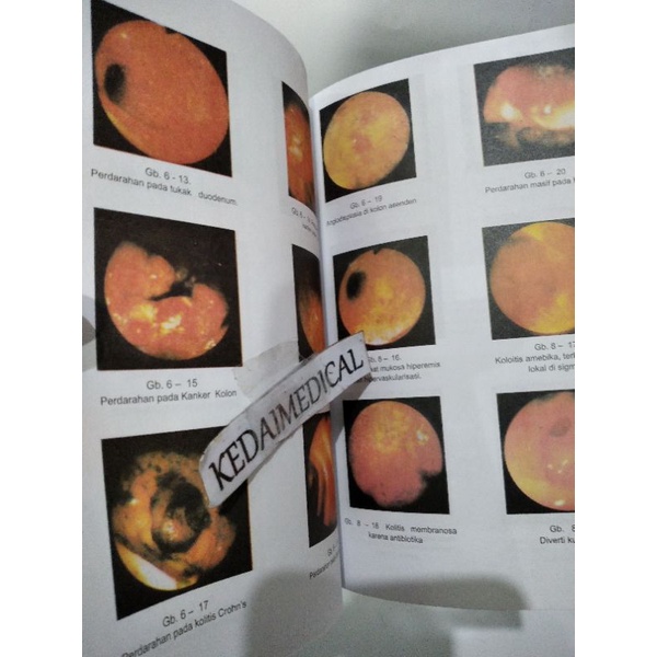 BUKU GASTROENTEROLOGI SUJONO HADI FULLCOLOUR TERMURAH