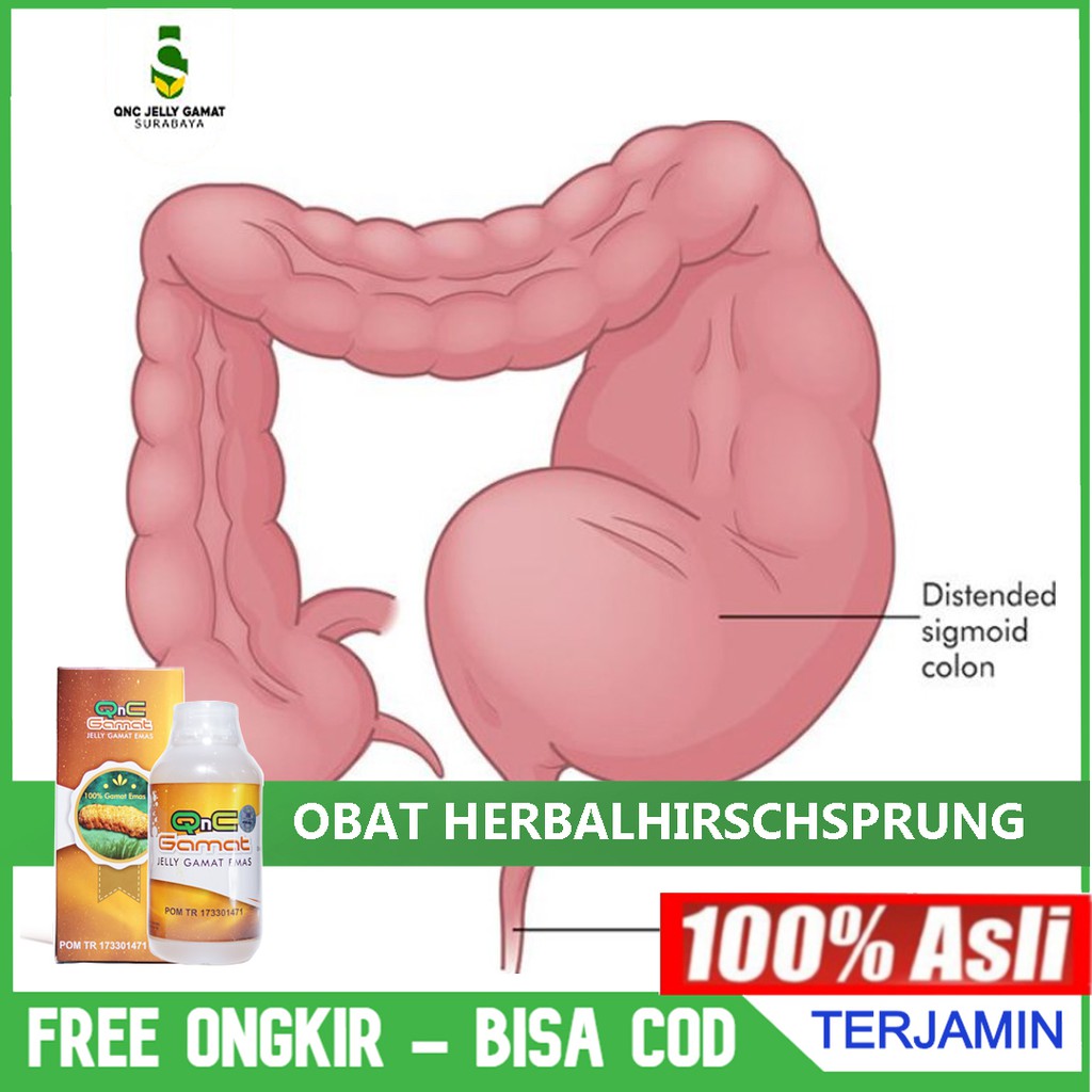 Obat Herbal Hirschsprung / Penyakit Hisprung , Sembelit Berkepanjangan Anak & Dewasa QnC Jelly Gamat