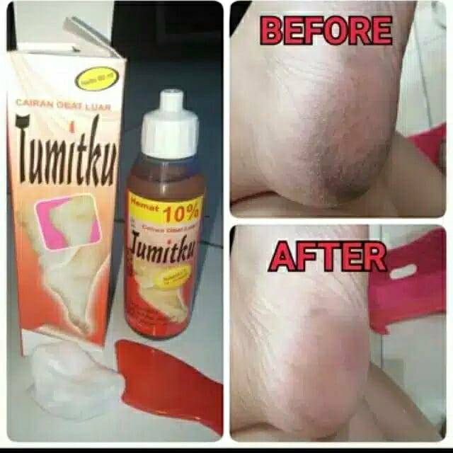 Tumitku 30ml
