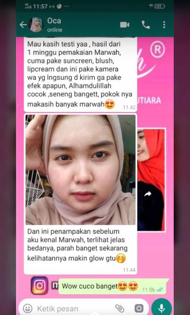 Diamond Acne Marwah Skincare HALAL &amp; BPOM