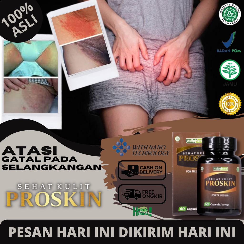 Obat Alami Gatal Selangkangan, Jamur Selangkangan, Selangkangan Lecet, Infeksi, Penghilang Gatal Sel