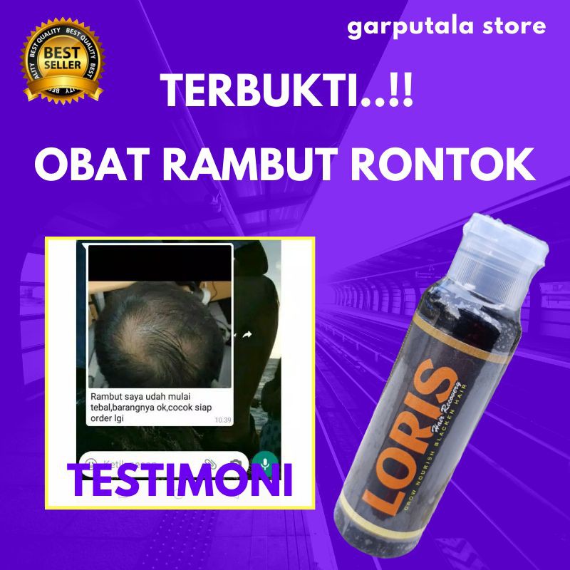 obat penumbuh rambut kepala botak penghitam rambut beruban permanen