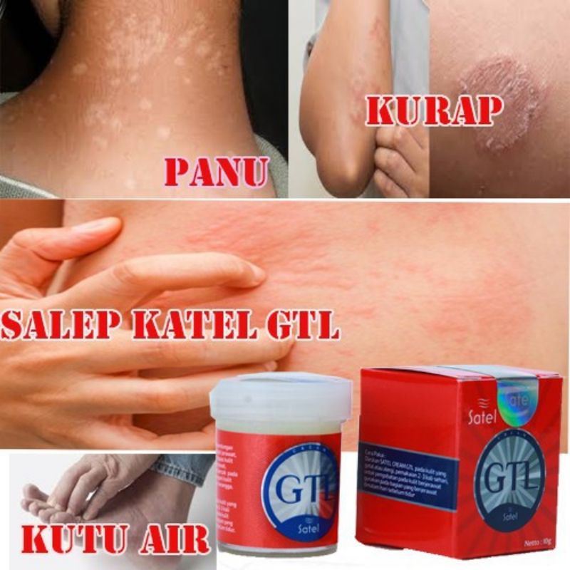 Satel Salep Gatel GTL Mengobati Jerawat Panu Kadas Kurap Eksim Gatelan Aman Bpom-2
