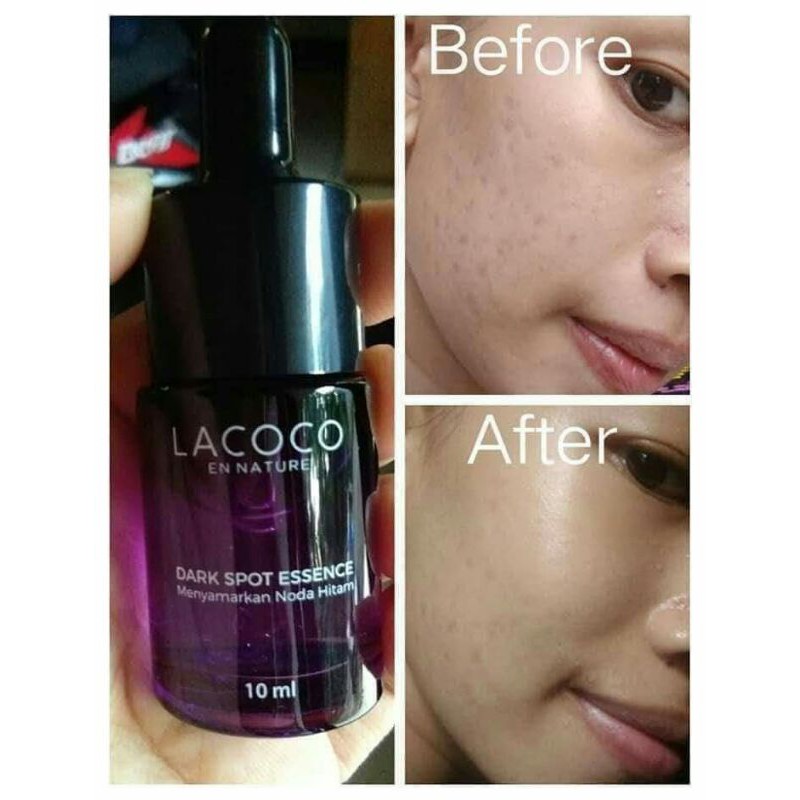 LACOCO ANTI FLEK HITAM NASA AMPUH MENGHILANGKAN FLEK HITAM MEMUTIHKAN & MENGGLOWINGKAN MENCERAHKAN