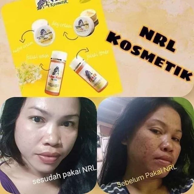 CREAM NRL KOSMETIK