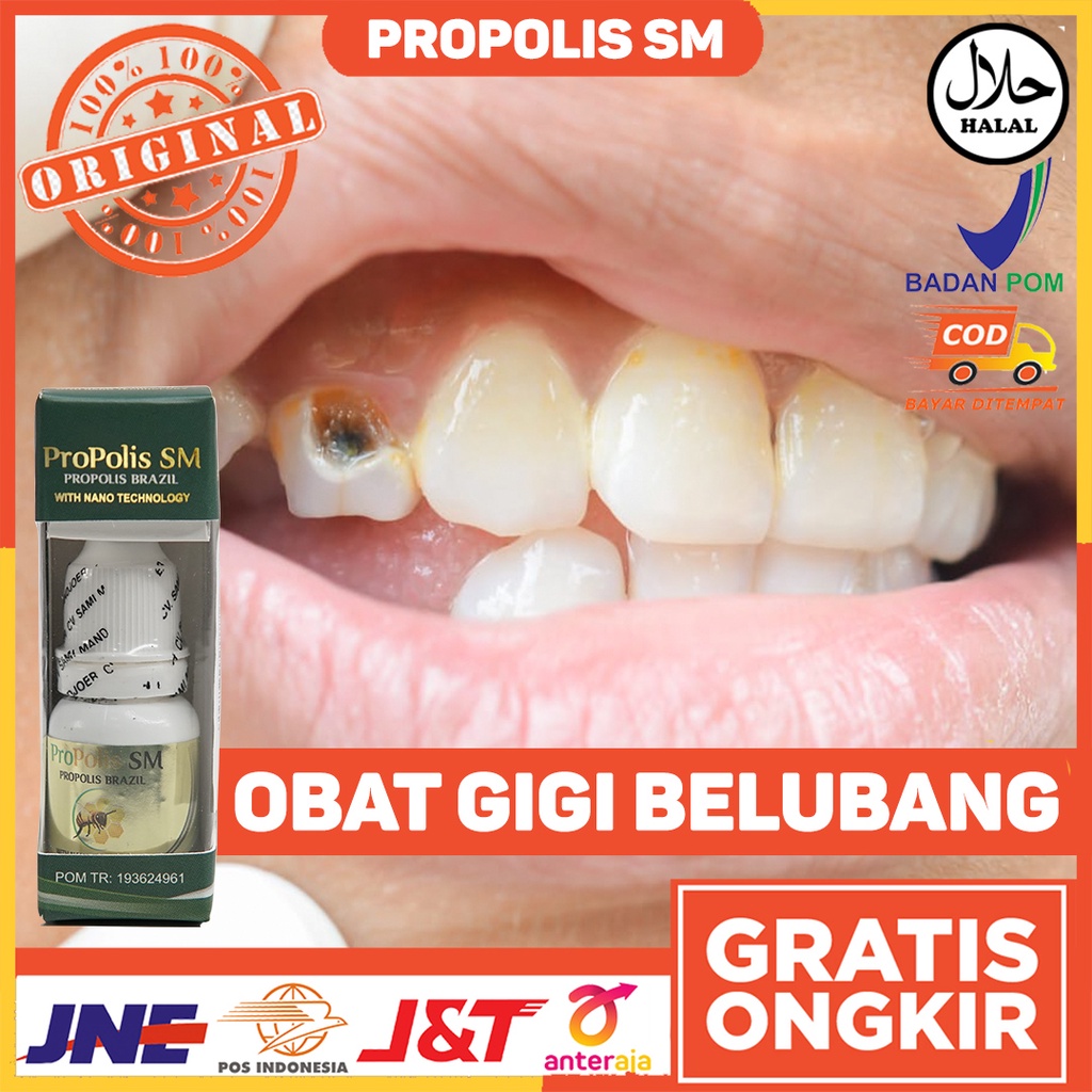 Obat Gigi Berlubang - Obat Gigi Berlubang Ngilu - Obat Gigi Berlubang Sakit - Obat Gigi Berlubang Tu