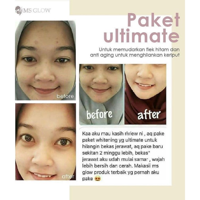 Paket Ultimate + Red Jelly Lactobacillus || MS GLOW