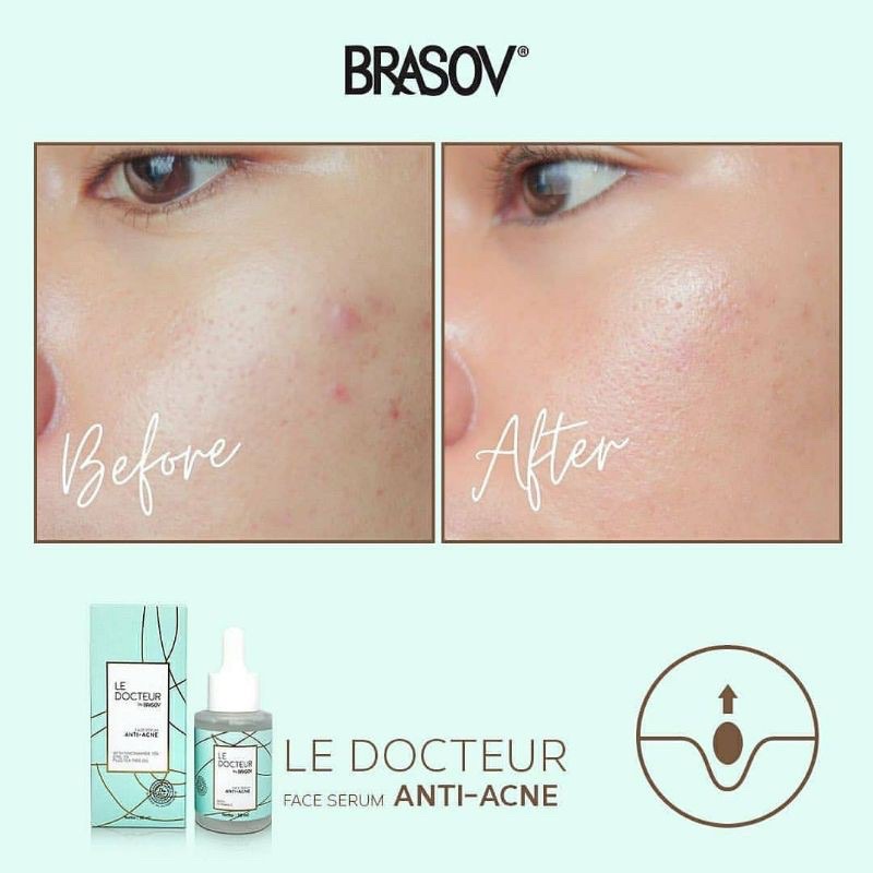 SERUM WAJAH LE DOCTEUR  BY BRASOV