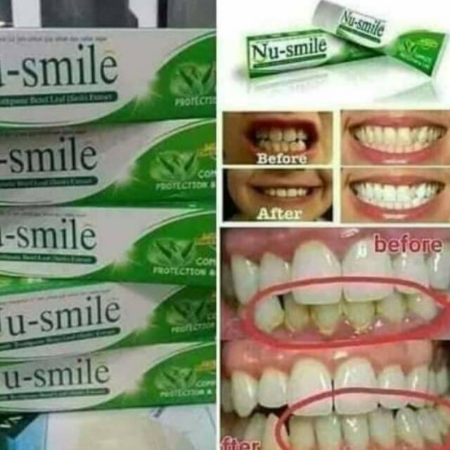 Nu-Smile