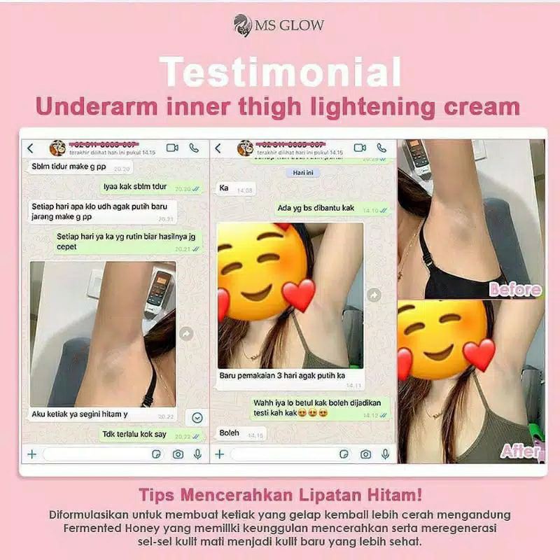 UNDERARM CREAM ORIGINAL by MS GLOW