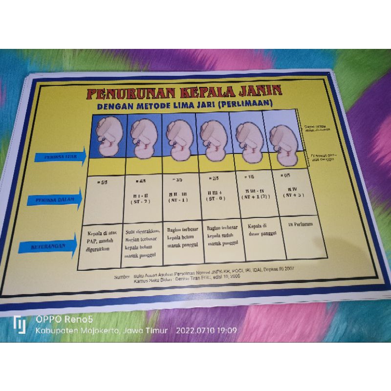 

Poster Penurunan Kepala Janin