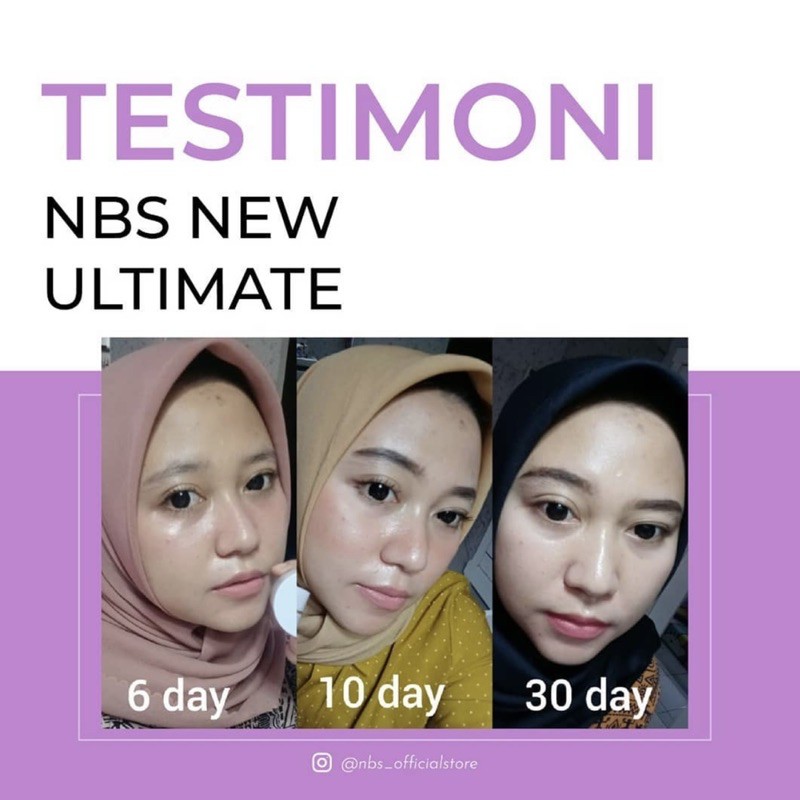 NBS EXTRA GLOW NEW PAKET NBS PEMUTIH WAJAH PENGHILANG FLEK JERAWAT KUSAM CREAM NBS ULTIMATE ORIGINAL BPOM-1