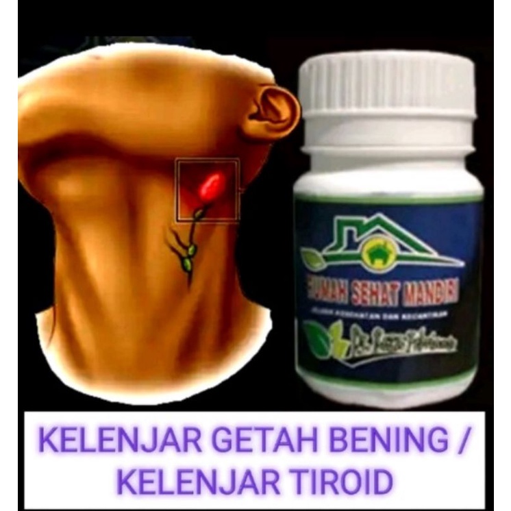 obat unt kelenjar getah bening/kelenjar tiroid
