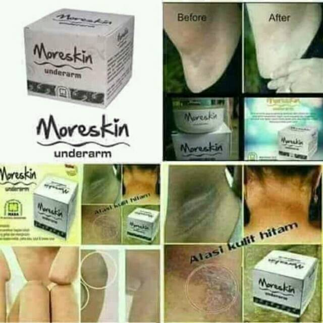 MORESKIN UNDERARM
