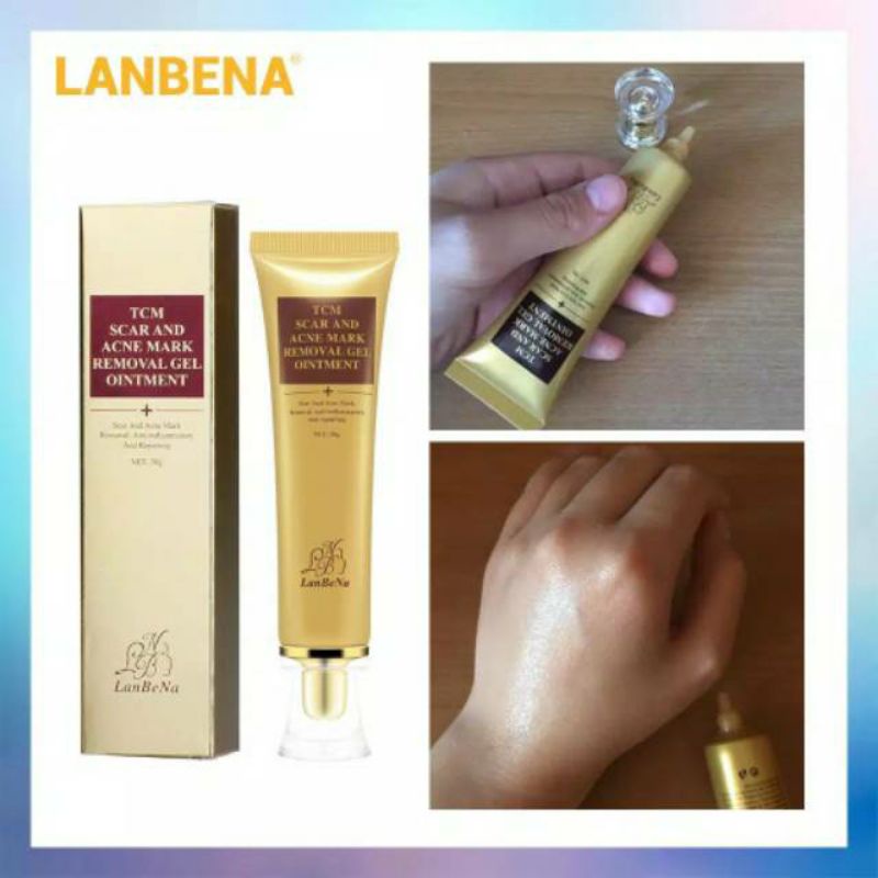 LANBENA Original Acne Removal Cream Perbaikan Kulit