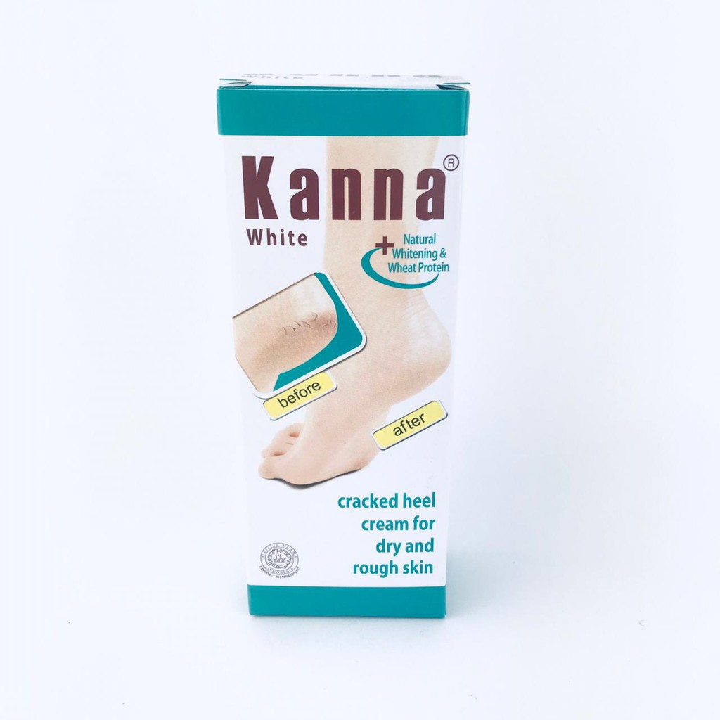 Kanna White Cream / Krim kaki / Krim Kulit Siku dan Lutut / 30g