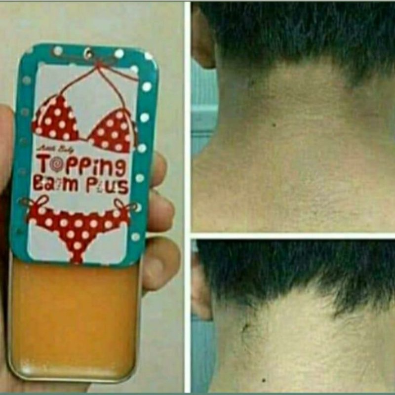 PEMUTIH KETIAK ATAU PEMUTIH LIPATAN