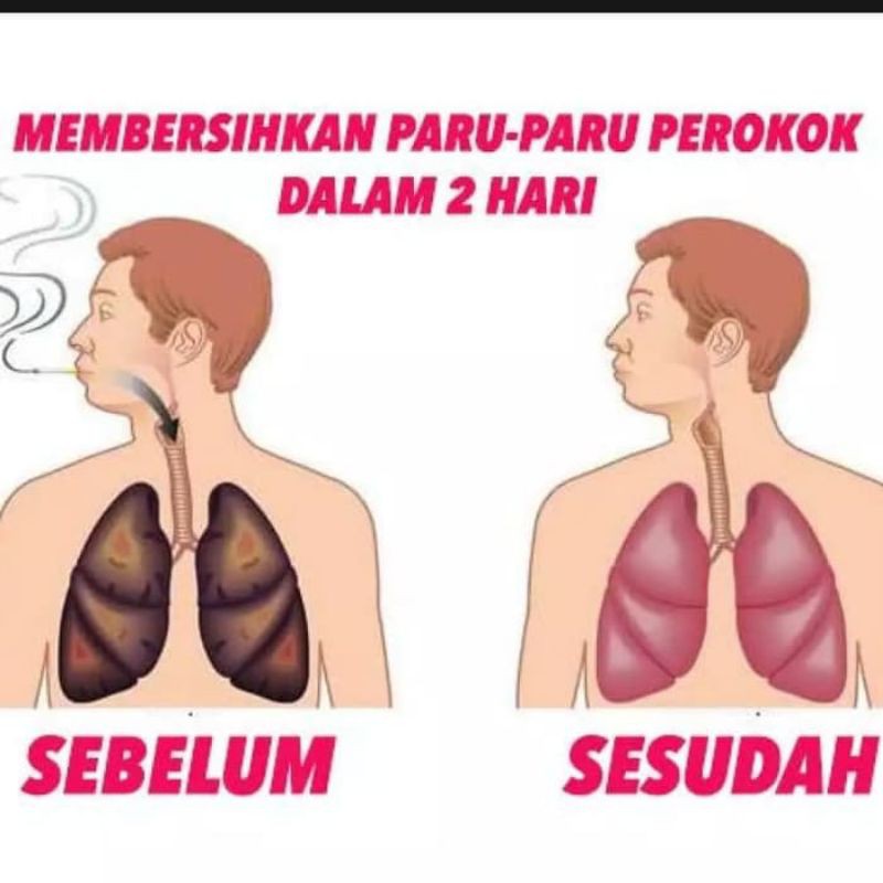 Obat herbal sesak nafas anosmia gurah paru tbc batuk berdahak gurah suara pilek sinusitis kering COD-8