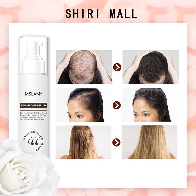 SHIRI Minyak Esensial Pertumbuhan Rambut Pelembab Menutrisi Kilau Mencegah Rambut Rontok Pertumbuhan