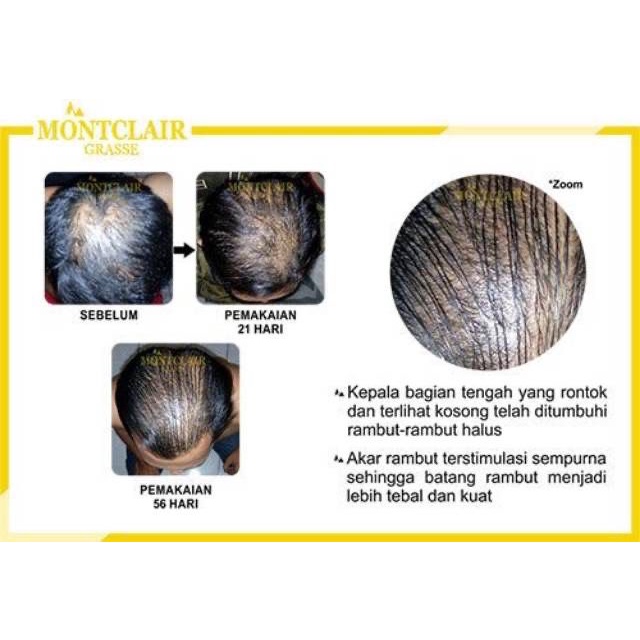 Montclair Hair Serum ORIGINAL 100% Best Seller Produk Penumbuh Rambut Bergaransi