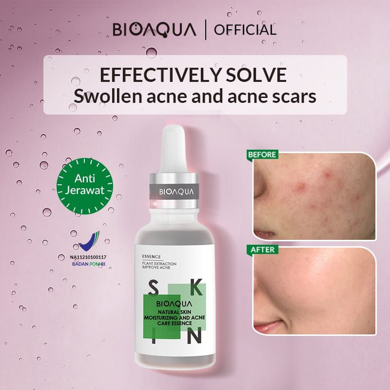 BIOAQUA Natural Skin Moisturizing And Acne Care Essence