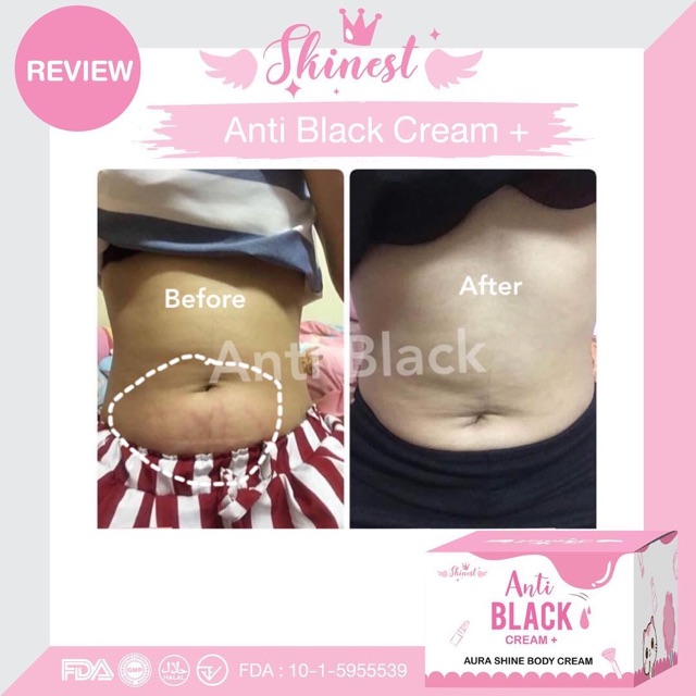 PENGHILANG STRECHMARK / CREAM PENGHILANG LUKA